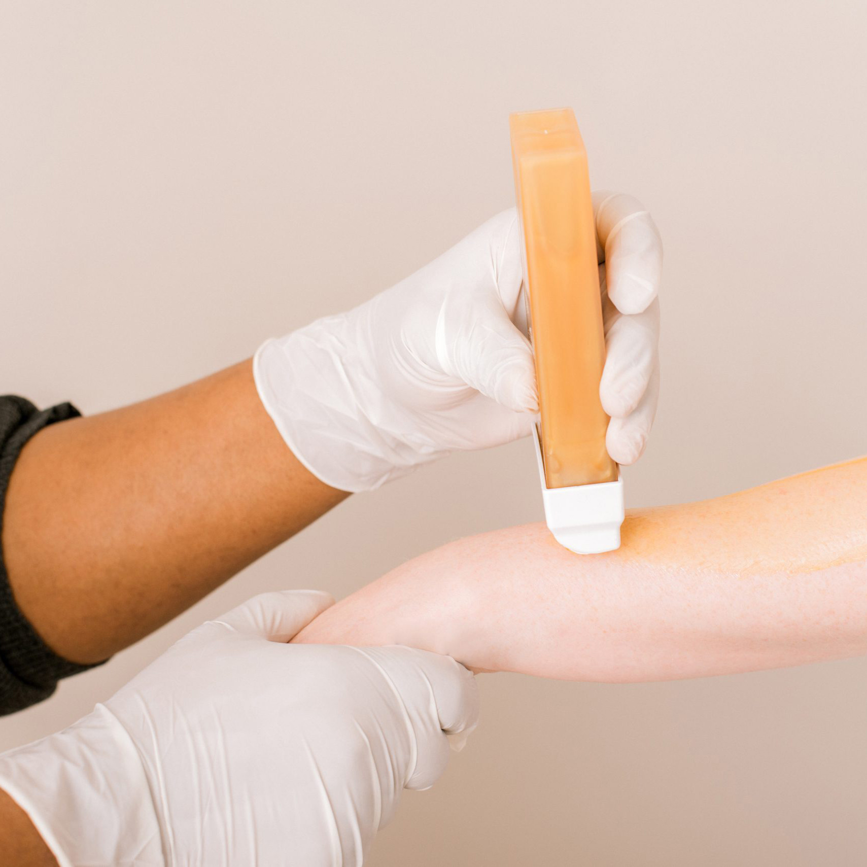 Gloved hand presses an orange handheld skincare device against a person's forearm during a treatment, close-up.